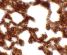 NETO1 Antibody - Immunohistochemistry of NETO1 in rat lung tissue with NETO1 antibody at 2.5 ug/ml.