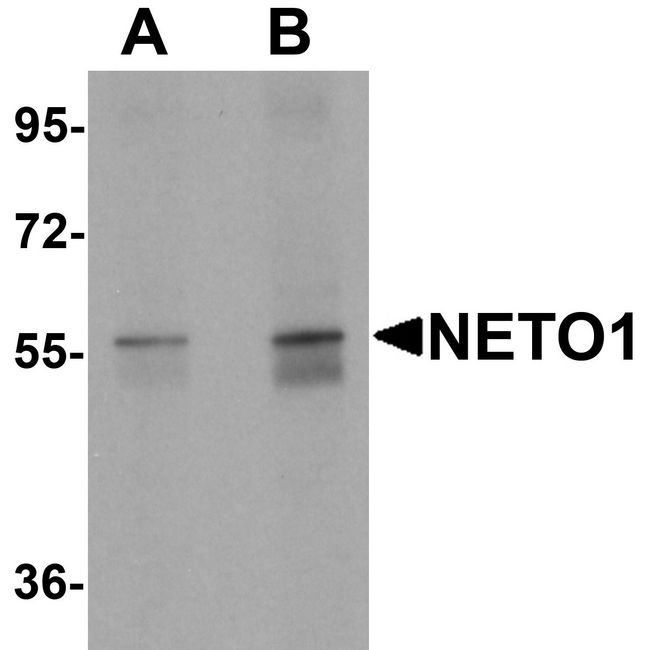 NETO1 Antibody - Western blot analysis of NETO1 in human lung tissue lysate with NETO1 antibody at (A) 1 and (B) 2 ug/ml.