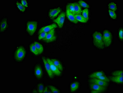 NETO1 Antibody - Immunofluorescence staining of HepG2 cells at a dilution of 1:200, counter-stained with DAPI. The cells were fixed in 4% formaldehyde, permeabilized using 0.2% Triton X-100 and blocked in 10% normal Goat Serum. The cells were then incubated with the antibody overnight at 4 °C.The secondary antibody was Alexa Fluor 488-congugated AffiniPure Goat Anti-Rabbit IgG (H+L) .