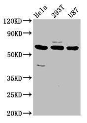 NETO1 Antibody - Positive Western Blot detected in Hela whole cell lysate, 293T whole cell lysate, U87 whole cell lysate. All lanes: NETO1 antibody at 3.2 µg/ml Secondary Goat polyclonal to rabbit IgG at 1/50000 dilution. Predicted band size: 61, 18 KDa. Observed band size: 61 KDa