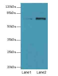 NETO2 Antibody - Western blot. All lanes: NETO2 antibody at 4 ug/ml. Lane 1: U251 whole cell lysate. Lane 2: MDA-MB-231 whole cell lysate. Secondary Goat polyclonal to Rabbit IgG at 1:10000 dilution. Predicted band size: 59 kDa. Observed band size: 70 kDa.