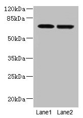 NETO2 Antibody - Western blot All lanes: NETO2 antibody at 4µg/ml Lane 1: U251 whole cell lysate Lane 2: MDA-MB-231 whole cell lysate Secondary Goat polyclonal to rabbit IgG at 1/10000 dilution Predicted band size: 60, 23, 59 kDa Observed band size: 70 kDa