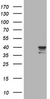 NEU1 / NEU Antibody - HEK293T cells were transfected with the pCMV6-ENTRY control (Left lane) or pCMV6-ENTRY NEU1 (Right lane) cDNA for 48 hrs and lysed. Equivalent amounts of cell lysates (5 ug per lane) were separated by SDS-PAGE and immunoblotted with anti-NEU1.