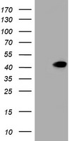 NEU1 / NEU Antibody - HEK293T cells were transfected with the pCMV6-ENTRY control (Left lane) or pCMV6-ENTRY NEU1 (Right lane) cDNA for 48 hrs and lysed. Equivalent amounts of cell lysates (5 ug per lane) were separated by SDS-PAGE and immunoblotted with anti-NEU1.