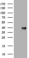 NEU1 / NEU Antibody - HEK293T cells were transfected with the pCMV6-ENTRY control (Left lane) or pCMV6-ENTRY NEU1 (Right lane) cDNA for 48 hrs and lysed. Equivalent amounts of cell lysates (5 ug per lane) were separated by SDS-PAGE and immunoblotted with anti-NEU1.