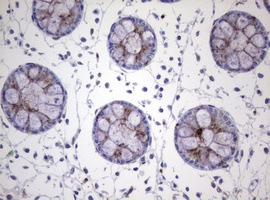 NEU1 / NEU Antibody - IHC of paraffin-embedded Human colon tissue using anti-NEU1 mouse monoclonal antibody.