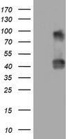 NEU1 / NEU Antibody - HEK293T cells were transfected with the pCMV6-ENTRY control (Left lane) or pCMV6-ENTRY NEU1 (Right lane) cDNA for 48 hrs and lysed. Equivalent amounts of cell lysates (5 ug per lane) were separated by SDS-PAGE and immunoblotted with anti-NEU1.