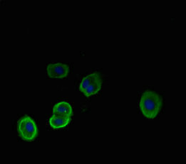 NEU1 / NEU Antibody - Immunofluorescent analysis of HepG2 cells using NEU1 Antibody at dilution of 1:100 and Alexa Fluor 488-congugated AffiniPure Goat Anti-Rabbit IgG(H+L)