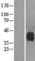 NEU1 / NEU Protein - Western validation with an anti-DDK antibody * L: Control HEK293 lysate R: Over-expression lysate