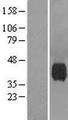 NEU1 / NEU Protein - Western validation with an anti-DDK antibody * L: Control HEK293 lysate R: Over-expression lysate