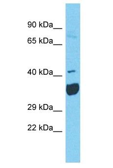NEU2 / Sialidase 2 Antibody - NEU2 antibody Western Blot of 293T. Antibody dilution: 1 ug/ml.  This image was taken for the unconjugated form of this product. Other forms have not been tested.