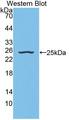NEU2 / Sialidase 2 Antibody - Western blot of NEU2 / Sialidase 2 antibody.
