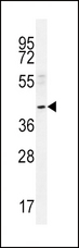 NEU2 / Sialidase 2 Antibody - NEU2 Antibody western blot of A549 cell line lysates (35 ug/lane). The NEU2 antibody detected the NEU2 protein (arrow).