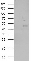 NEU2 / Sialidase 2 Antibody - HEK293T cells were transfected with the pCMV6-ENTRY control (Left lane) or pCMV6-ENTRY NEU2 (Right lane) cDNA for 48 hrs and lysed. Equivalent amounts of cell lysates (5 ug per lane) were separated by SDS-PAGE and immunoblotted with anti-NEU2.