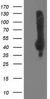NEU2 / Sialidase 2 Antibody - HEK293T cells were transfected with the pCMV6-ENTRY control (Left lane) or pCMV6-ENTRY NEU2 (Right lane) cDNA for 48 hrs and lysed. Equivalent amounts of cell lysates (5 ug per lane) were separated by SDS-PAGE and immunoblotted with anti-NEU2.