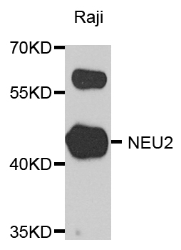 NEU2 / Sialidase 2 Antibody - Western blot analysis of extract of various cells.