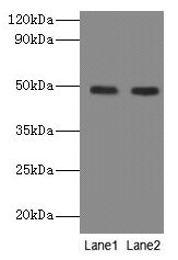 NEU3 Antibody - Western blot All lanes: Sialidase-3 antibody at 2µg/ml Lane 1: A549 whole cell lysate Lane 2: U251 whole cell lysate Secondary Goat polyclonal to rabbit IgG at 1/10000 dilution Predicted band size: 49, 52 kDa Observed band size: 49 kDa