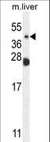 NEU4 Antibody - NEU4 Antibody western blot of mouse liver tissue lysates (35 ug/lane). The NEU4 antibody detected the NEU4 protein (arrow).