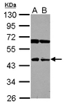 NEU4 Antibody - Sample (30 ug of whole cell lysate) A: 293T B: A431 10% SDS PAGE NEU4 antibody diluted at 1:500