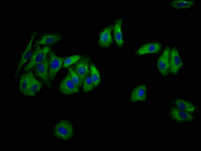 NEU4 Antibody - Immunofluorescence staining of HepG2 cells at a dilution of 1:133, counter-stained with DAPI. The cells were fixed in 4% formaldehyde, permeabilized using 0.2% Triton X-100 and blocked in 10% normal Goat Serum. The cells were then incubated with the antibody overnight at 4 °C.The secondary antibody was Alexa Fluor 488-congugated AffiniPure Goat Anti-Rabbit IgG (H+L) .