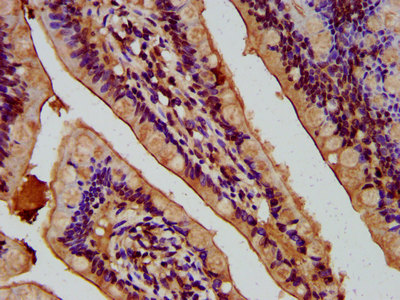 NEU4 Antibody - Immunohistochemistry image at a dilution of 1:400 and staining in paraffin-embedded human small intestine tissue performed on a Leica BondTM system. After dewaxing and hydration, antigen retrieval was mediated by high pressure in a citrate buffer (pH 6.0) . Section was blocked with 10% normal goat serum 30min at RT. Then primary antibody (1% BSA) was incubated at 4 °C overnight. The primary is detected by a biotinylated secondary antibody and visualized using an HRP conjugated SP system.