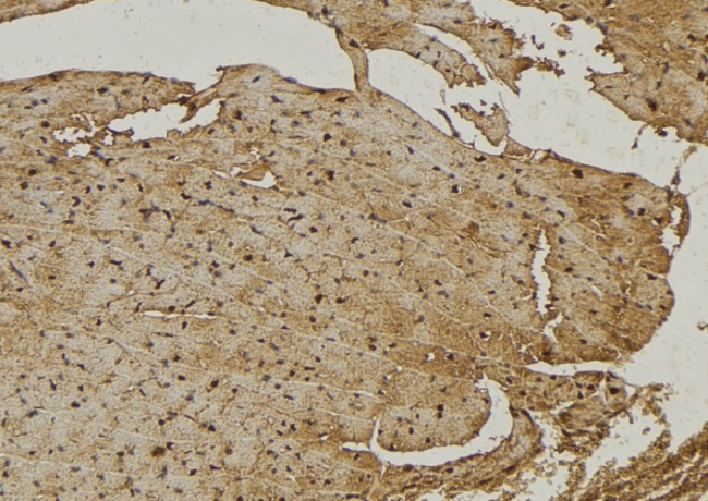 NEU4 Antibody - 1:100 staining mouse muscle tissue by IHC-P. The sample was formaldehyde fixed and a heat mediated antigen retrieval step in citrate buffer was performed. The sample was then blocked and incubated with the antibody for 1.5 hours at 22°C. An HRP conjugated goat anti-rabbit antibody was used as the secondary.