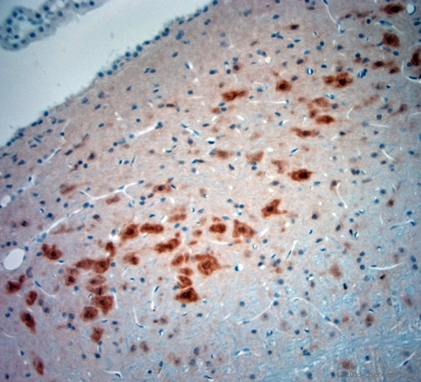 NeuN Antibody - Rabbit antibody to NeuN (80-130). IHC-P on paraffin sections of rat brain. The animal was perfused using Autoperfuser at a pressure of 110 mm Hg with 300 ml 4% FA and further post fixed overnight before being processed for paraffin embedding. HIER: Tris-EDTA, pH 9 for 20 min using Thermo PT Module. Blocking: 0.2% LFDM in TBST filtered through a 0.2 micron filter. Detection was done using Novolink HRP polymer from Leica following manufacturers instructions. Primary antibody: dilution 1:1000, incubated 30 min at RT using Autostainer. Sections were counterstained with Harris Hematoxylin.