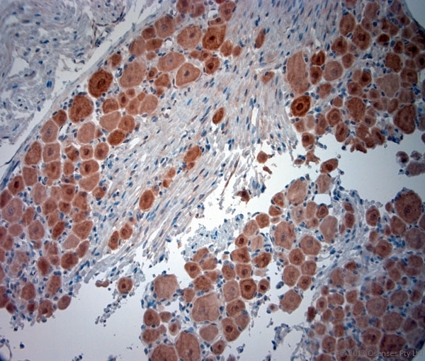 NeuN Antibody - Rabbit antibody to NeuN (80-130). IHC-P on paraffin sections of rat DRG. The animal was perfused using Autoperfuser at a pressure of 110 mm Hg with 300 ml 4% FA and further post fixed overnight before being processed for paraffin embedding. HIER: Tris-EDTA, pH 9 for 20 min using Thermo PT Module. Blocking: 0.2% LFDM in TBST filtered through a 0.2 micron filter. Detection was done using Novolink HRP polymer from Leica following manufacturers instructions. Primary antibody: dilution 1:1000, incubated 30 min at RT using Autostainer. Sections were counterstained with Harris Hematoxylin.