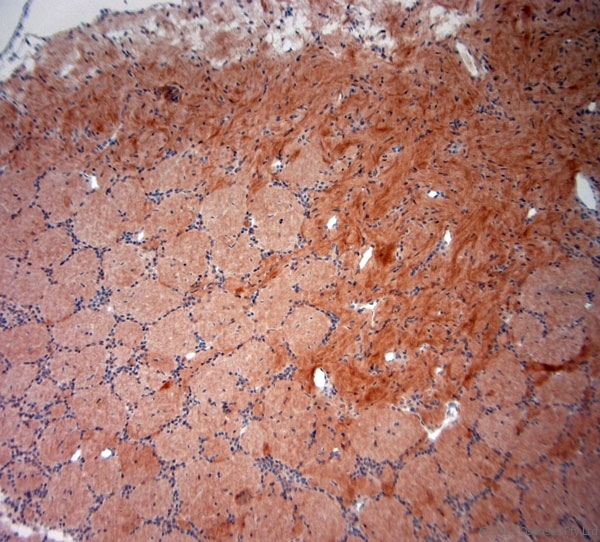 NeuN Antibody - Rabbit antibody to NeuN (80-130). IHC-P on paraffin sections of rat olfactory. The animal was perfused using Autoperfuser at a pressure of 110 mm Hg with 300 ml 4% FA and further post fixed overnight before being processed for paraffin embedding. HIER: Tris-EDTA, pH 9 for 20 min using Thermo PT Module. Blocking: 0.2% LFDM in TBST filtered through a 0.2 micron filter. Detection was done using Novolink HRP polymer from Leica following manufacturers instructions. Primary antibody: dilution 1:1000, incubated 30 min at RT using Autostainer. Sections were counterstained with Harris Hematoxylin.