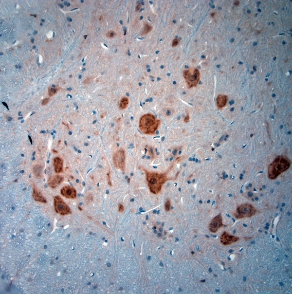 NeuN Antibody - Rabbit antibody to NeuN (80-130). IHC-P on paraffin sections of rat spinal cord. The animal was perfused using Autoperfuser at a pressure of 110 mm Hg with 300 ml 4% FA and further post fixed overnight before being processed for paraffin embedding. HIER: Tris-EDTA, pH 9 for 20 min using Thermo PT Module. Blocking: 0.2% LFDM in TBST filtered through a 0.2 micron filter. Detection was done using Novolink HRP polymer from Leica following manufacturers instructions. Primary antibody: dilution 1:1000, incubated 30 min at RT using Autostainer. Sections were counterstained with Harris Hematoxylin.