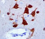 NeuN Antibody - IHC of NeuN on FFPE Brain tissue. This image was taken for the unmodified form of this product. Other forms have not been tested.