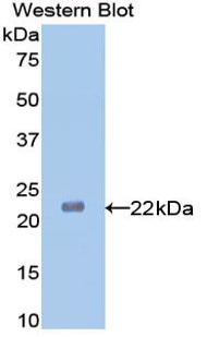 Neuraminidase Antibody - Western blot of recombinant Neuraminidase.  This image was taken for the unconjugated form of this product. Other forms have not been tested.