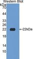 Neuraminidase Antibody