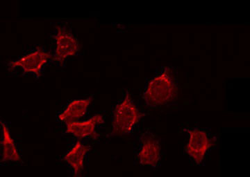 NEURL1 / NEURL Antibody - Staining MCF-7 cells by IF/ICC. The samples were fixed with PFA and permeabilized in 0.1% Triton X-100, then blocked in 10% serum for 45 min at 25°C. The primary antibody was diluted at 1:200 and incubated with the sample for 1 hour at 37°C. An Alexa Fluor 594 conjugated goat anti-rabbit IgG (H+L) Ab, diluted at 1/600, was used as the secondary antibody.