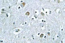 NEURL1 / NEURL Antibody - IHC of Neuralized-1 (V250) pAb in paraffin-embedded human brain tissue.