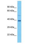 NEURL1B Antibody - NEURL1B antibody Western Blot of MCF7. Antibody dilution: 1 ug/ml.  This image was taken for the unconjugated form of this product. Other forms have not been tested.