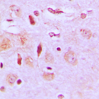 NEURL2 Antibody - Immunohistochemical analysis of NEURL2 staining in human brain formalin fixed paraffin embedded tissue section. The section was pre-treated using heat mediated antigen retrieval with sodium citrate buffer (pH 6.0). The section was then incubated with the antibody at room temperature and detected using an HRP conjugated compact polymer system. DAB was used as the chromogen. The section was then counterstained with hematoxylin and mounted with DPX.
