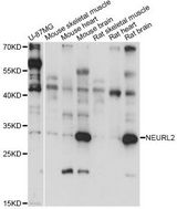 NEURL2 Antibody - Western blot analysis of extracts of various cell lines, using NEURL2 antibody at 1:1000 dilution. The secondary antibody used was an HRP Goat Anti-Rabbit IgG (H+L) at 1:10000 dilution. Lysates were loaded 25ug per lane and 3% nonfat dry milk in TBST was used for blocking. An ECL Kit was used for detection and the exposure time was 15s.