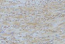 NEURL2 Antibody - 1:100 staining mouse muscle tissue by IHC-P. The sample was formaldehyde fixed and a heat mediated antigen retrieval step in citrate buffer was performed. The sample was then blocked and incubated with the antibody for 1.5 hours at 22°C. An HRP conjugated goat anti-rabbit antibody was used as the secondary.