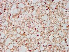 Neurochondrin Antibody - Immunohistochemistry image at a dilution of 1:500 and staining in paraffin-embedded human brain tissue performed on a Leica BondTM system. After dewaxing and hydration, antigen retrieval was mediated by high pressure in a citrate buffer (pH 6.0) . Section was blocked with 10% normal goat serum 30min at RT. Then primary antibody (1% BSA) was incubated at 4 °C overnight. The primary is detected by a biotinylated secondary antibody and visualized using an HRP conjugated SP system.