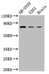 Neurochondrin Antibody - Positive Western Blot detected in SH-SY5Y whole cell lysate, U251 whole cell lysate, Rat brain tissue. All lanes: NCDN antibody at 2.6 µg/ml Secondary Goat polyclonal to rabbit IgG at 1/50000 dilution. Predicted band size: 79, 78, 80 KDa. Observed band size: 79 KDa