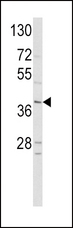 NEUROD1 Antibody - Western blot of hNeuroD1-Q30 in HepG2 cell line lysates (35 ug/lane). NEUROD1 (arrow) was detected using the purified antibody.