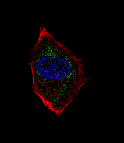 NEUROD1 Antibody - Fluorescent confocal image of HepG2 cell stained with hNeuroD1-Q30. HepG2 cells were fixed with 4% PFA (20 min), permeabilized with Triton X-100 (0.1%, 10 min), then incubated with hNeuroD1-Q30 primary antibody (1:25, 1 h at 37°C). For secondary antibody, Alexa Fluor 488 conjugated donkey anti-rabbit antibody (green) was used (1:400, 50 min at 37°C). Cytoplasmic actin was counterstained with Alexa Fluor 555 (red) conjugated Phalloidin (7units/ml, 1 h at 37°C). Nuclei were counterstained with DAPI (blue) (10 ug/ml, 10 min). hNeuroD1-Q30 immunoreactivity is localized to vesicles significantly.