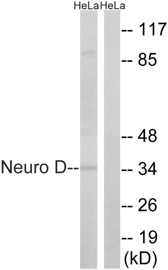 NEUROD1 Antibody - Western blot analysis of lysates from HeLa cells, using Neuro D Antibody. The lane on the right is blocked with the synthesized peptide.