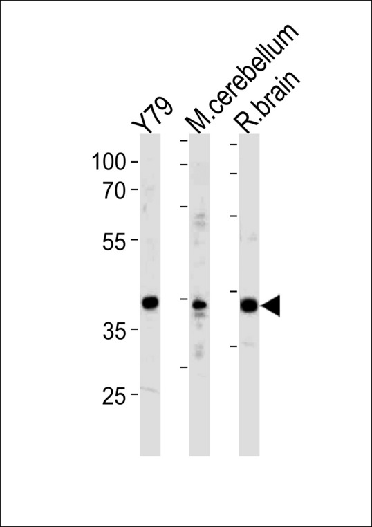 NEUROD1 Antibody - NeuroD1 Antibody (I333) western blot of Y79 cell line ,mouse cerebellum and rat brain tissue lysates (35 ug/lane). The NeuroD1 antibody detected the NeuroD1 protein (arrow).