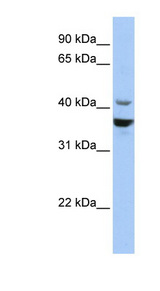NEUROD1 Antibody - NEUROD1 antibody Western blot of HepG2 cell lysate. This image was taken for the unconjugated form of this product. Other forms have not been tested.