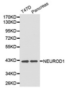 NEUROD1 Antibody - Western blot analysis of T47D cell and pancreas cell lysate.