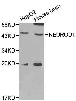 NEUROD1 Antibody - Western blot analysis of extracts of various cell lines, using NEUROD1 antibody at 1:1000 dilution. The secondary antibody used was an HRP Goat Anti-Rabbit IgG (H+L) at 1:10000 dilution. Lysates were loaded 25ug per lane and 3% nonfat dry milk in TBST was used for blocking.