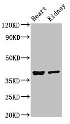 NEUROD1 Antibody - Western Blot Positive WB detected in:Mouse heart tissue,Mouse kidney tissue All Lanes:NEUROD1 antibody at 4µg/ml Secondary Goat polyclonal to rabbit IgG at 1/50000 dilution Predicted band size: 40 KDa Observed band size: 40 KDa