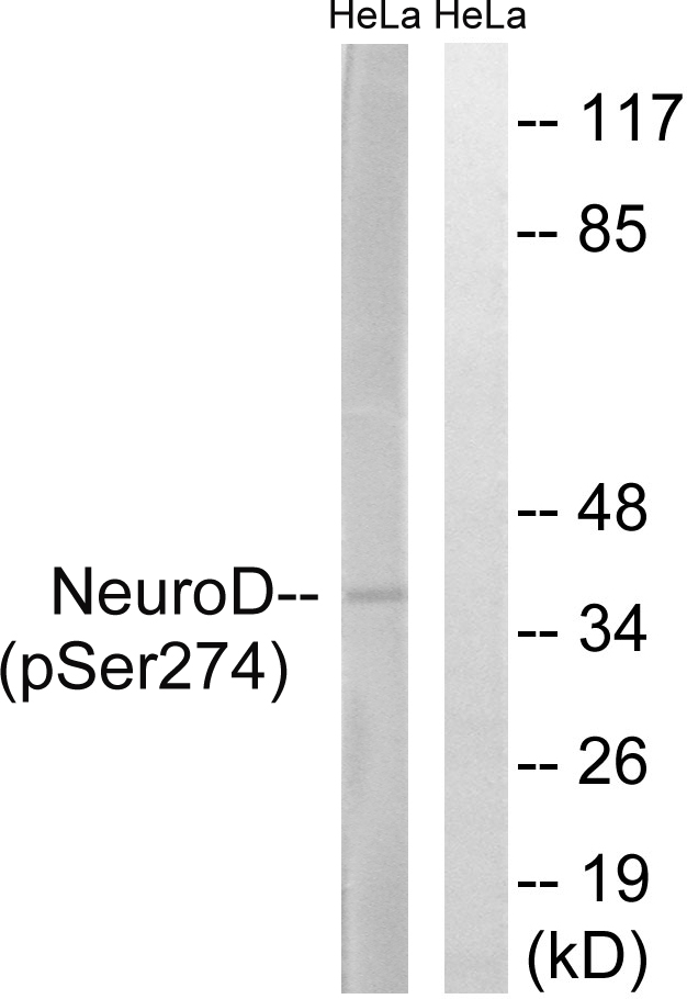 NEUROD1 Antibody - Western blot analysis of lysates from HeLa cells treated with UV 15', using Neuro D (Phospho-Ser274) Antibody. The lane on the right is blocked with the phospho peptide.